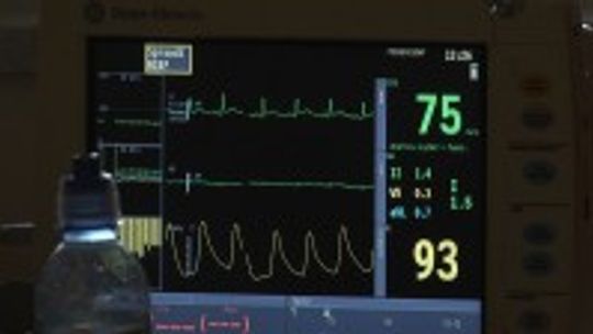 10 Kliniki Kardiochirurgii w Wojewódzkim Szpitalu Zespolonym w Kielcach