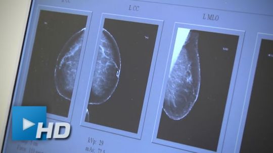 „Jestem kobietą więc idę. Mammografia"