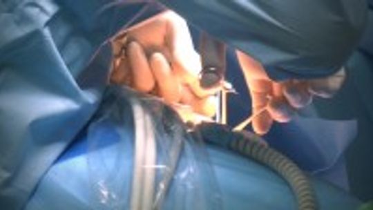 Kilkuset lekarzy wypowiedziało klauzule opt-out