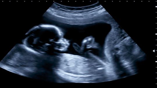 Kobieta w ciąży pod troskliwym nadzorem