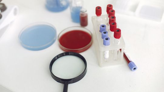 Koronawirus. Sytuacja epidemiologiczna w regionie