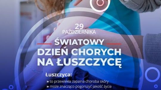 Łuszczyca – choroba przewlekła, ale nie zakaźna