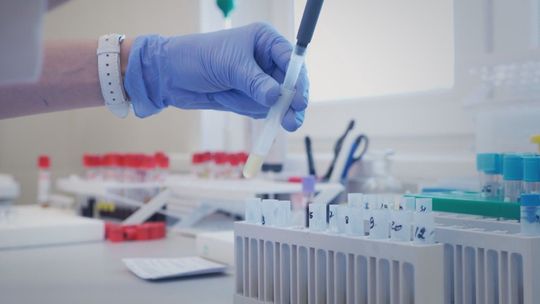 Miliony złotych na laboratoria