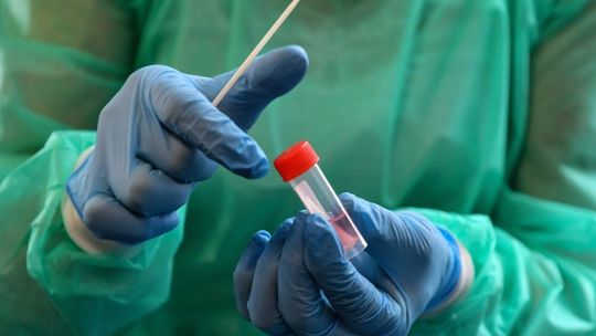 MZ: 14 578 przypadków zakażenia koronawirusem, zmarło 65 osób