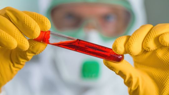 MZ: 20 870 nowych przypadków zakażenia koronawirusem, zmarło 461 osób