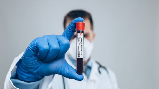 MZ: wkrótce możliwych 20 tys. testów na koronawirusa na dobę