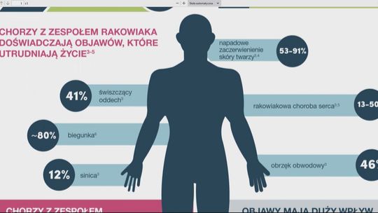 Zachorowalność na guzy neuroendokrynne wciąż rośnie