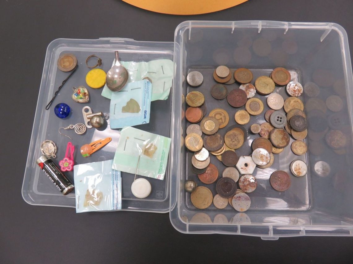 Dzieci potrafią połknąć wszystko. Lekarz Świętokrzyskiego Centrum Pediatrii ostrzega Dzieci potrafią połknąć wszystko. Lekarz Świętokrzyskiego Centrum Pediatrii ostrzega