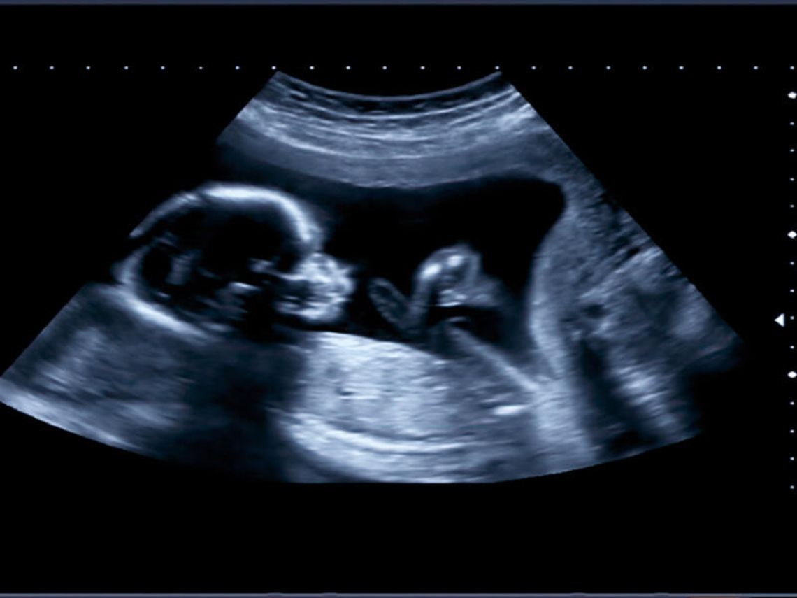 Kobieta w ciąży pod troskliwym nadzorem