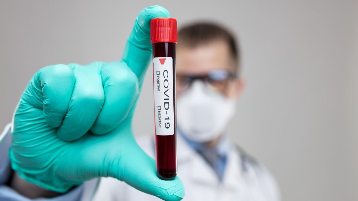 Kraska: według epidemiologów jesienią może być więcej nowych zakażeń koronawirusem