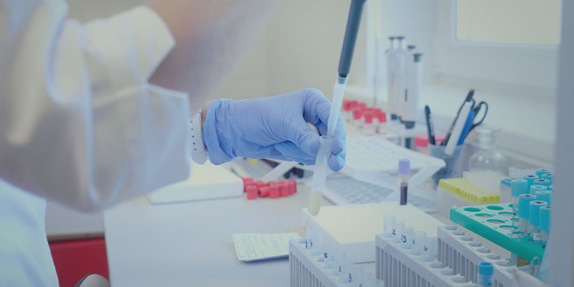 Ministerstwo Zdrowia: 25 052 nowe zakażenia koronawirusem, 453 chorych zmarło