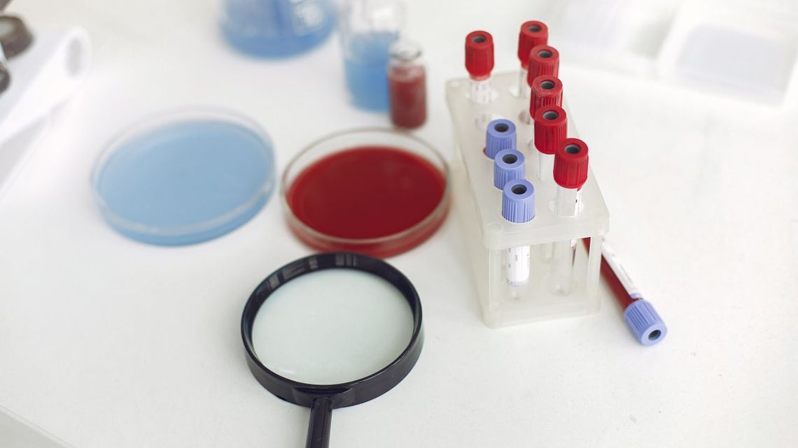 Więcej testów i sprzętu dla świętokrzyskich szpitali